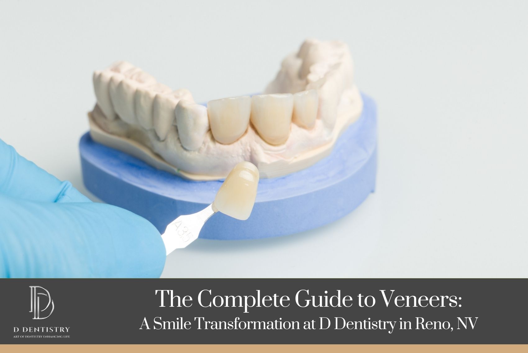 The Complete Guide to Veneers A Smile Transformation at D Dentistry in Reno, NV1